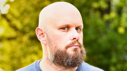 Does using creatine lead to baldness?